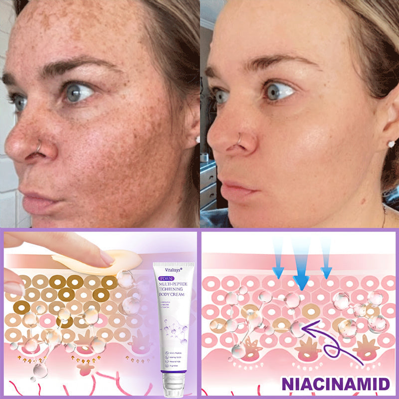 Vitalisys®❤️PDRN Multi-Peptide Massaging Body Roller Cream- Anti-aging, Hydrating, Skin Firming & Lifting, Skin Repair, Even Tone, Acne and Dark Spot Treatment, Wart and Mole Removal, and Psoriasis Relief.