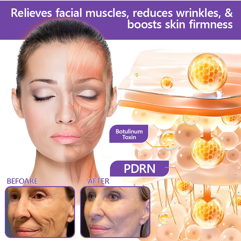 Vitalisys®❤️PDRN Multi-Peptide Massaging Body Roller Cream- Anti-aging, Hydrating, Skin Firming & Lifting, Skin Repair, Even Tone, Acne and Dark Spot Treatment, Wart and Mole Removal, and Psoriasis Relief.