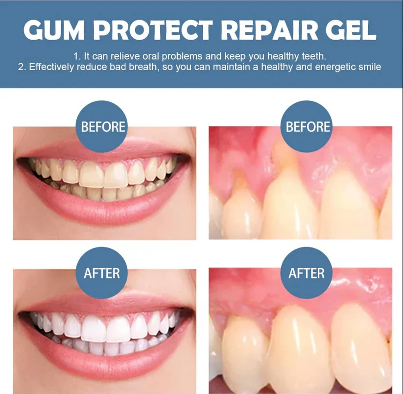 Muwix™ Teeth Repair Gel