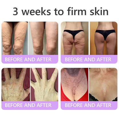 Vitalisys®❤️PDRN Multi-Peptide Massaging Body Roller Cream- Anti-aging, Hydrating, Skin Firming & Lifting, Skin Repair, Even Tone, Acne and Dark Spot Treatment, Wart and Mole Removal, and Psoriasis Relief.