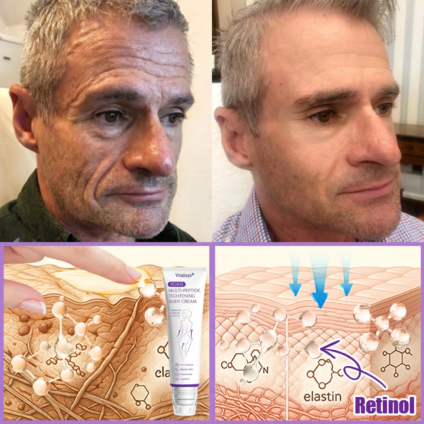 Vitalisys®❤️PDRN Multi-Peptide Massaging Body Roller Cream- Anti-aging, Hydrating, Skin Firming & Lifting, Skin Repair, Even Tone, Acne and Dark Spot Treatment, Wart and Mole Removal, and Psoriasis Relief.