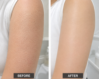 My lotion works better afterward