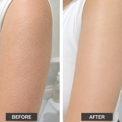 My lotion works better afterward