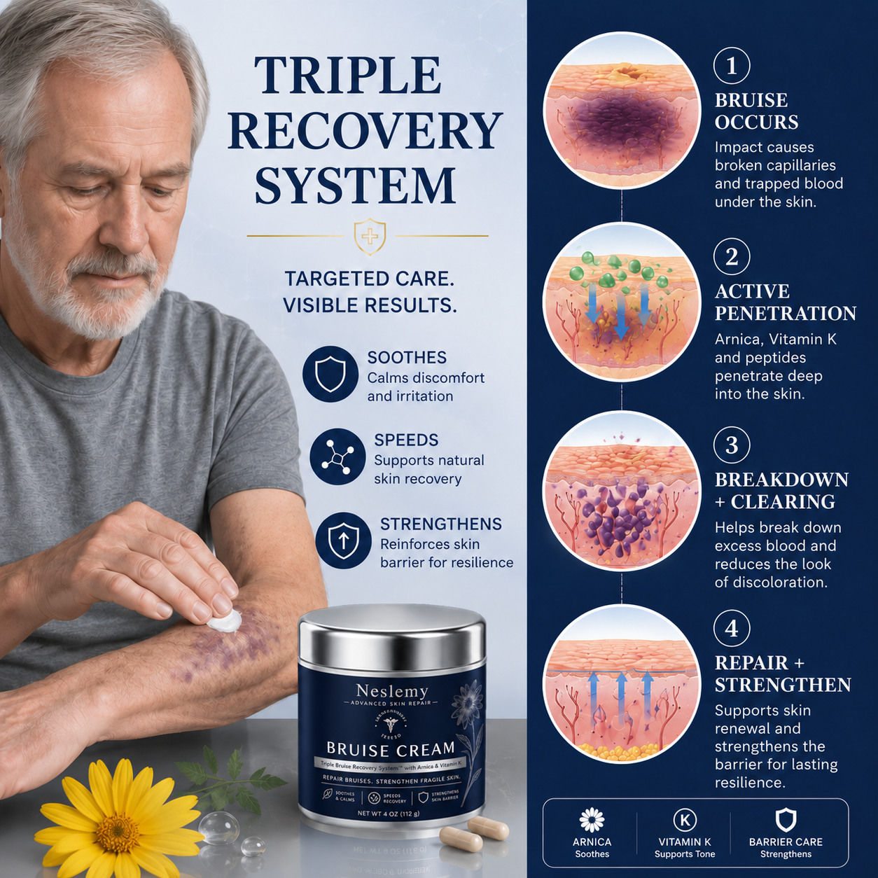 💥100K+ SOLD💕- Neslemy® Bruise Repair & Skin-Strengthening Cream