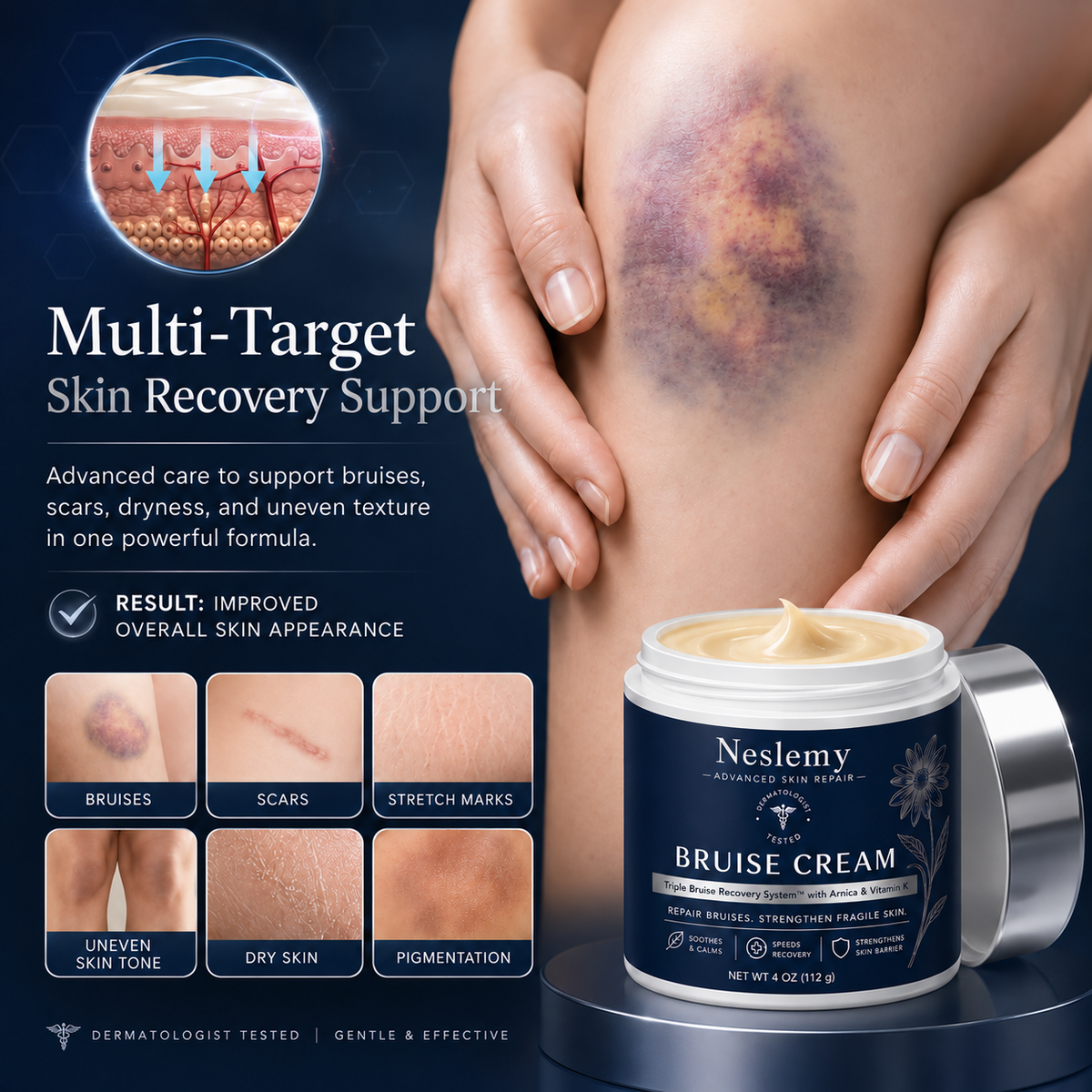 💥100K+ SOLD💕- Neslemy® Bruise Repair & Skin-Strengthening Cream